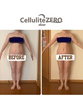 メリッサ(Melissa)/見た目が変わると人も変わる