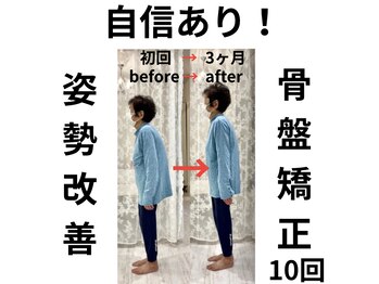 ケートータルビューティー(K. total beauty)/骨盤矯正で姿勢改善！