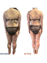 ベリップ 横浜店(Berip)/全身痩せ