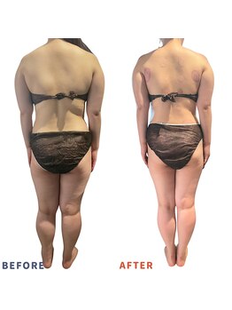 ベリップ 横浜店(Berip)/全身痩せ