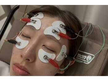 タキパンクチャー鍼灸院(TAKIPUN9TURE鍼灸院)の写真/目のクマ・たるみ・眼精疲労に集中。疲れた目元をスッキリ整える新しい目元ケアサービス