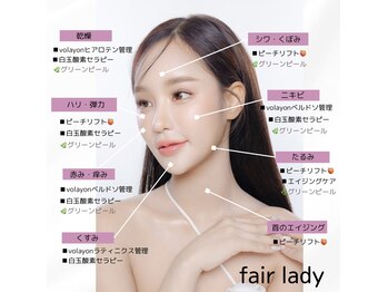 フェア レディ(fair lady)