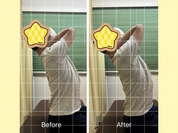 ナオル整体 春日部院(NAORU整体)/春日部/整体/姿勢矯正/猫背矯正