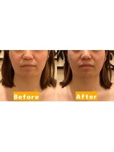 アジール 長岡リバーサイド千秋店(agir)/Before/After画像