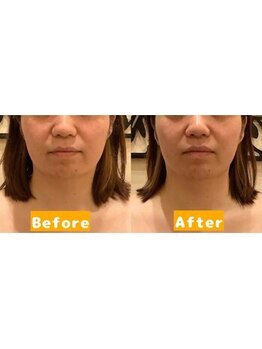 アジール 長岡リバーサイド千秋店(agir)/Before/After画像