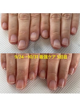 縦長のお爪に変化しました!