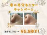 【残り２名！】AHA+BHA+セラムの3段式ハイドロ毛穴洗浄モニター　¥5,980！
