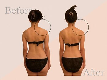 ファミーユ 名古屋店/【首肩こり改善ケア】むくみ