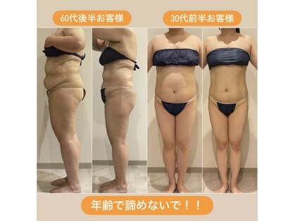 クラヴェル(Clavel)の写真