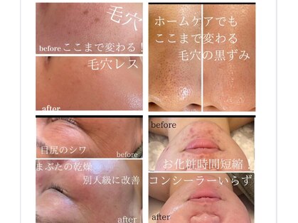 ボディキュア グランド(Body cure Grand)の写真