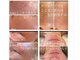 ボディキュア グランド(Body cure Grand)の写真