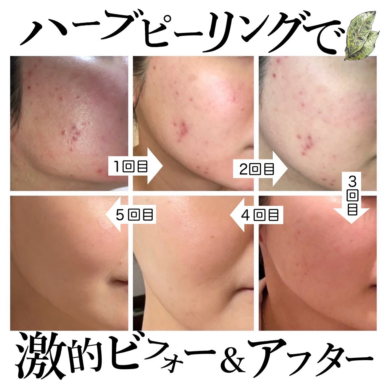 ハーブガレージ 心斎橋店(HERB garage)｜ホットペッパービューティー