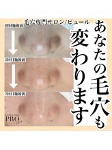 ピュール 鯖江店(PUR)/毛穴/毛穴ケア/毛穴洗浄