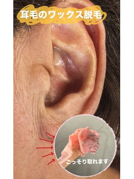 ナミル 札幌店(namir)/【閲覧注意】耳毛ワックス