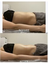 ウル(Ulu)/腸もみビフォーアフター