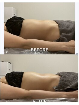 ウル(Ulu)/腸もみビフォーアフター