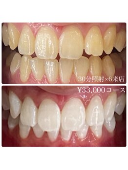 ホワイトニングルーム 横浜店(Whitening Room)/セルフホワイトニング/横浜