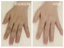 キレイテ 上野店/30代/4回目【ハンドケア上野】