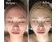 アドネ(Adone)の写真/【結果重視】最新筋膜マシンで大人女性のたるみ・お顔の脂肪を優しくケア★すっきり整う上品な小顔へ♪