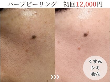 シェノン(Chainon)の写真