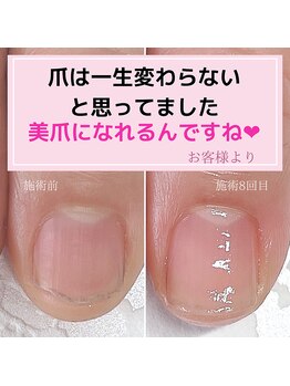 ミミ(mimi)/美爪になれるんですね！