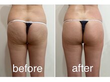 トータルビューティーサロン ナーズ(NAZ)/