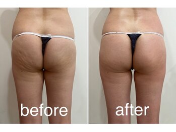 トータルビューティーサロン ナーズ(NAZ)/