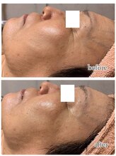 アロマ&クレイケアルーム ネロリドール(Nerolidol)/深いシワケアにも。