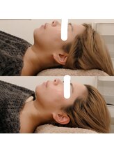 ニューミー スパ(newme spa)/小顔矯正。