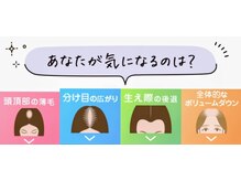 ミヨン ヨコハマ(Miyonne Yokohama)/頭皮は、どれ？上大岡/港南台