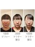 【小顔矯正】契約者予約専用