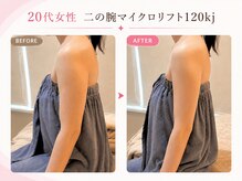 リフト 門前仲町(Lift)/小顔専門店Lift｜痩身施術
