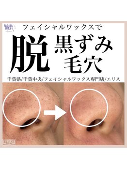 エリス(ELISSE)/ずっとは隠せない黒ずみ毛穴