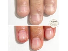 カロッス(Kallos)の雰囲気（深爪などのお悩みもお任せください！　 ）