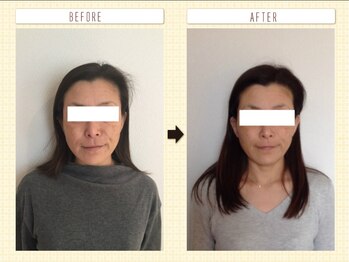 美容整体ウェリナ あま甚目寺院/小顔矯正/骨盤矯正/美脚サロン