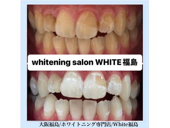 ホワイトニングサロン ホワイト(WHITE)/セルフホワイトニング/大阪/福島