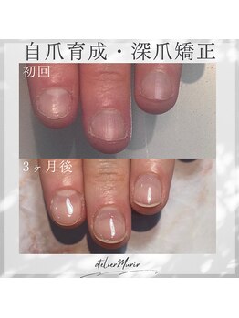 アトリエ ミュリー 代官山(atelier murir)/自爪育成・深爪矯正・巻き爪ケア