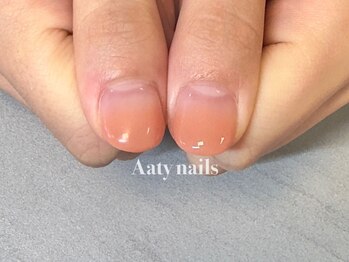 アーティネイルズ(Aaty Nails)の写真/繰り返す深爪も初回から見た目改善◎自爪風でバレずに深爪矯正も可能！
