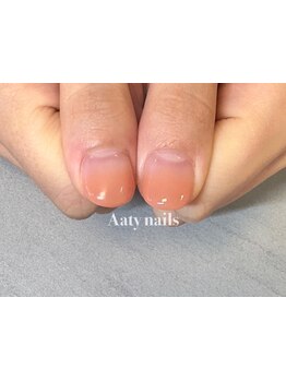 爪の悩みを解消できる（ケア含む）