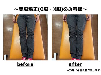 トータルビューティーみつとも/O脚矯正/美脚矯正