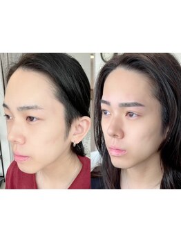 メンズにオススメのサロン