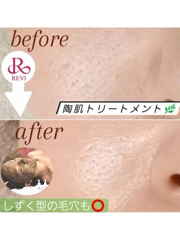 ピエナ(Piena)/大人気☆陶肌トリートメント