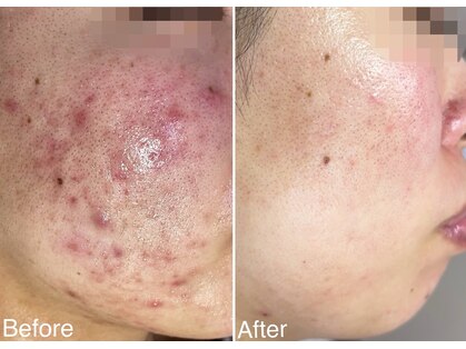 ラブリボンの写真