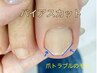 【爪切りのみ】爪の形を正しく削って爪の変形の予防に努める◎