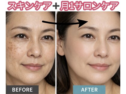 ヴィーナスハンドの写真