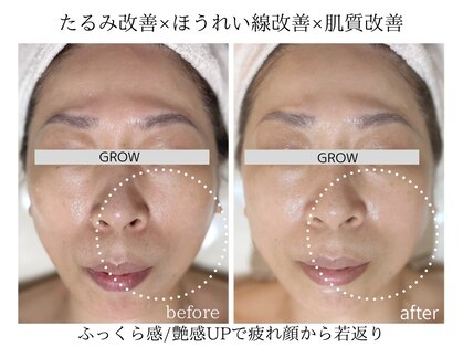 グロウ バイ フェイシャルデザイン アンド アイ(GROW)の写真