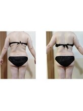 ラトゥリア(laturia)/自分ではケアしづらい背中も