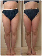 リノ(Lino)/50代一回でスッキリ変化