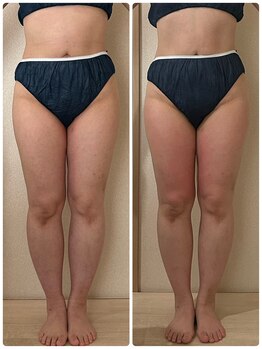 リノ(Lino)/50代一回でスッキリ変化
