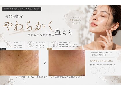 毛穴研究所の写真